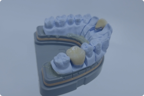 歯の模型に色を塗っている技工士