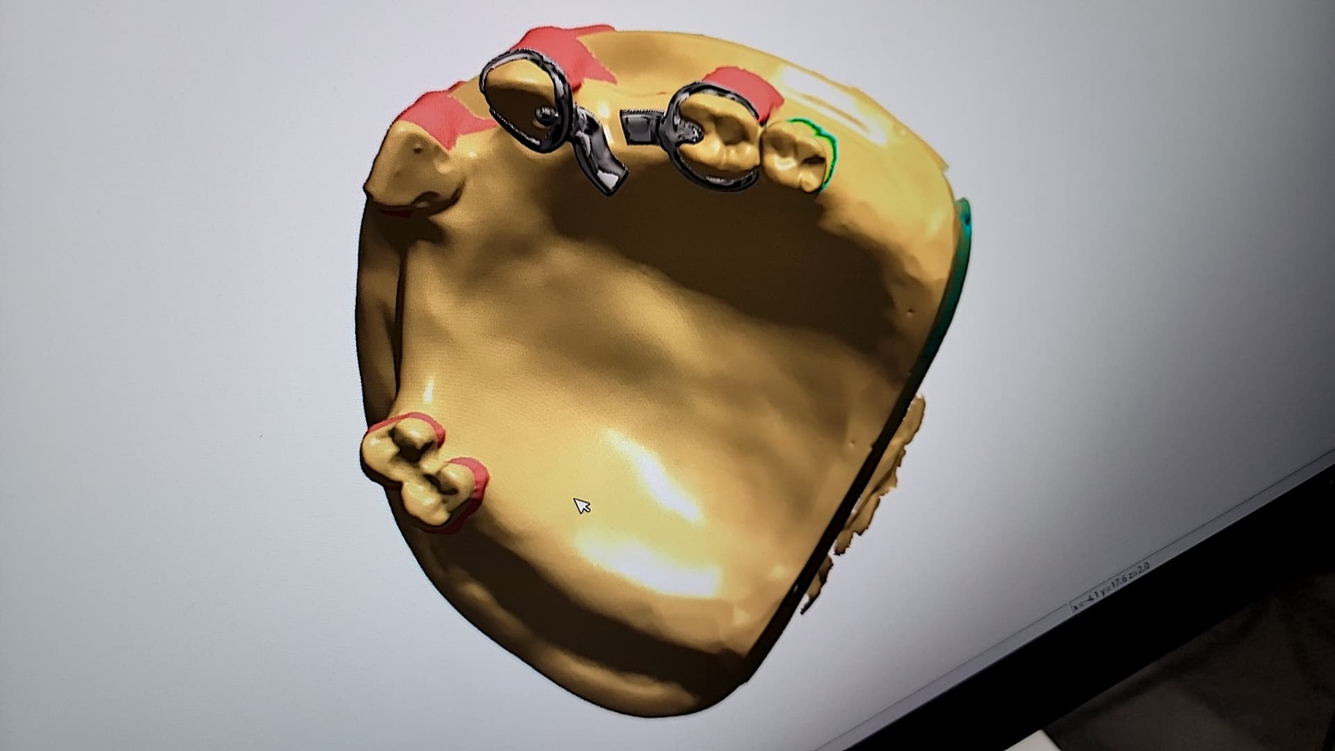 青いゴム手袋を装着し、歯の模型に色を付ける歯科技工士
